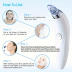 Blackhead clean GENAI  Beauty Meter - Portable Facial Pore Cleaner with 4 Probes, Gentle and Safe Cleansing for Men and Women, Battery-Operated (Batteries Not Included)